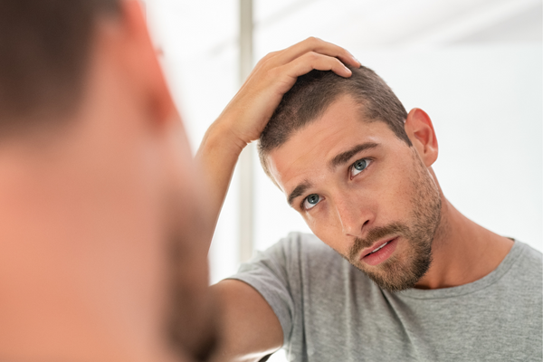 Nuevo tratamiento para la alopecia androgenética en hombres transgénero
